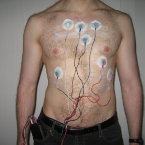 Patient Monitoring