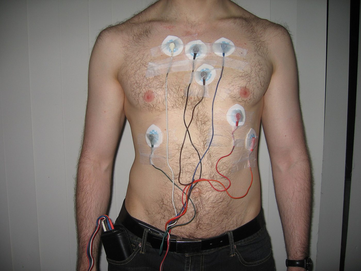 Patient Monitoring