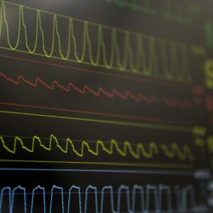Patient Monitoring