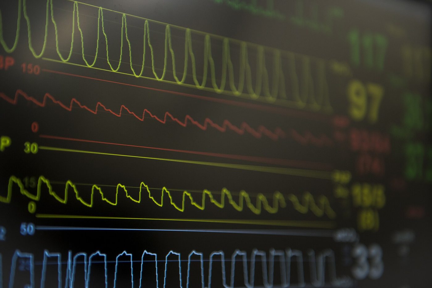 Patient Monitoring