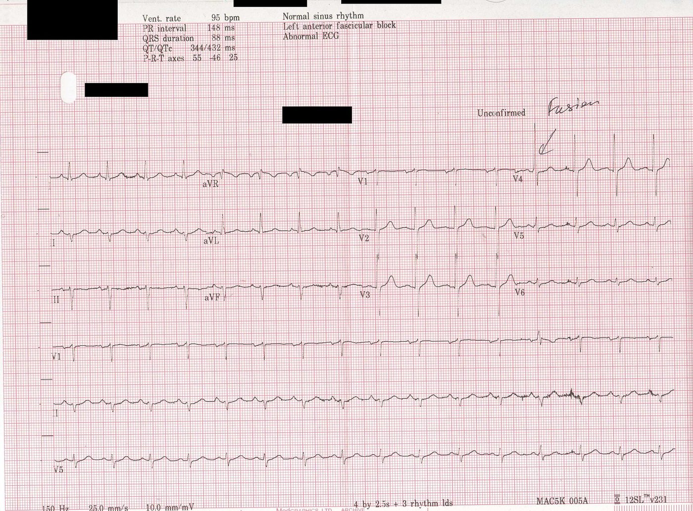 Patient Monitoring